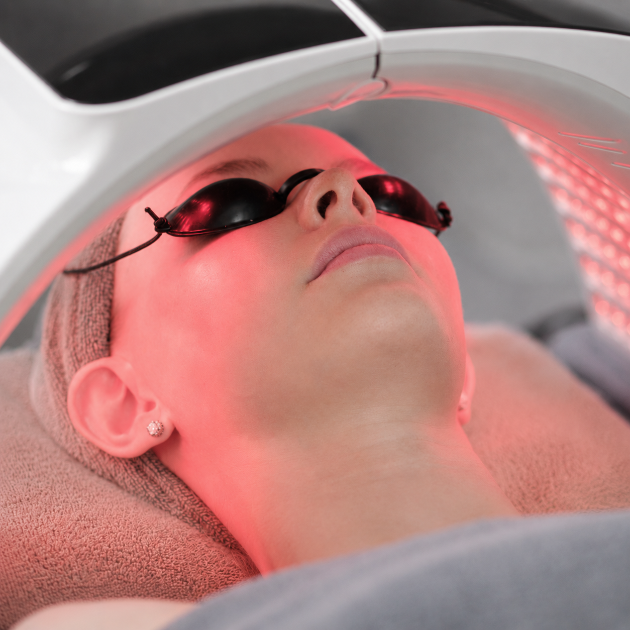 Microneedling Facial