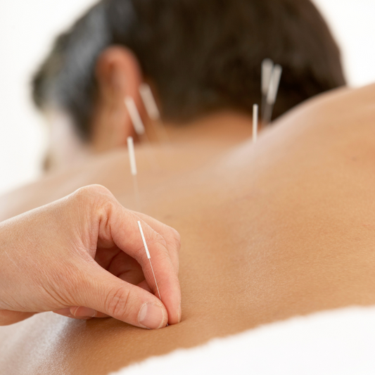 ACUPUNCTURE