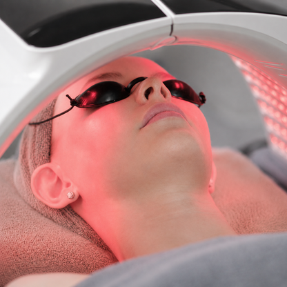Microneedling Facial