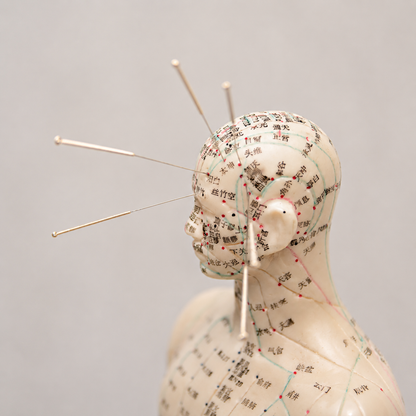 Facial Acupuncture