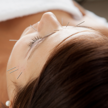 Facial Acupuncture