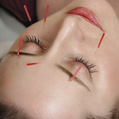 Facial Acupuncture