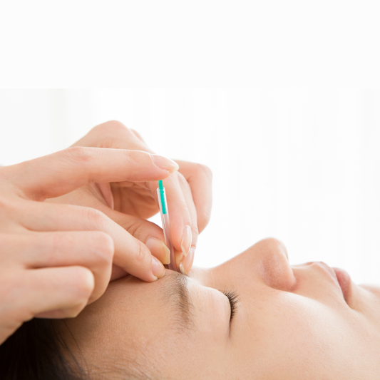 Facial Acupuncture
