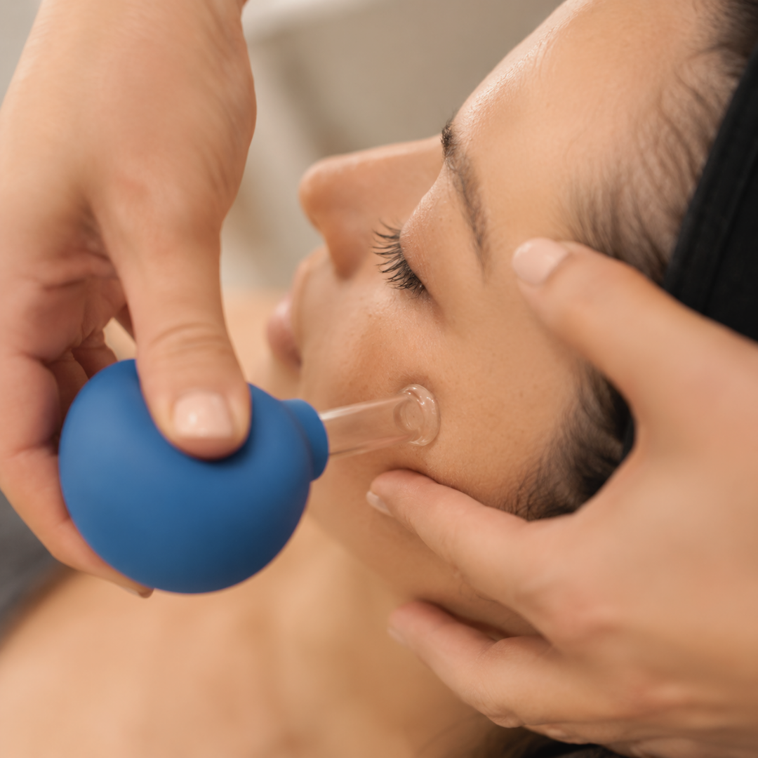 Facial Acupuncture