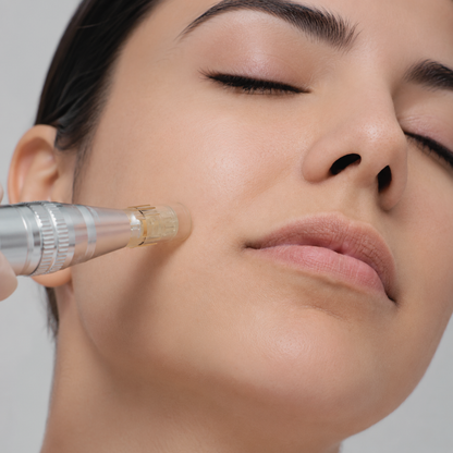 Nanoneedling Facial