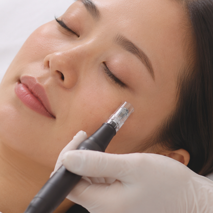 Nanoneedling Facial